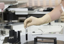 帕金森綜合癥有哪些表現(xiàn)  預(yù)防需要做好哪些