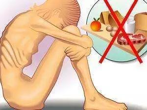 神經(jīng)性厭食