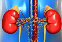 小兒腎病綜合征