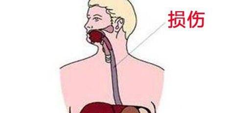 食管腐蝕傷