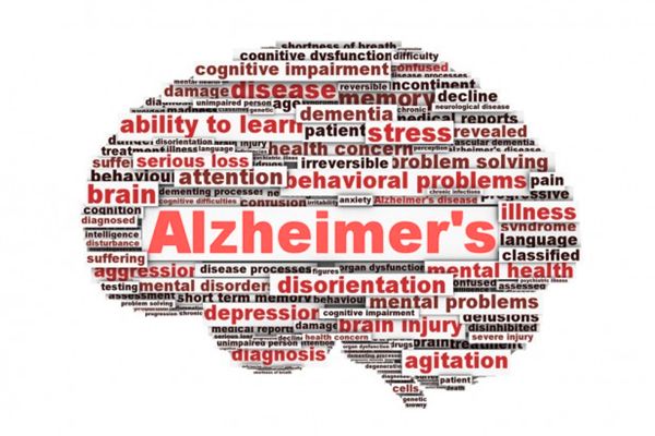 阿茲海默癥
