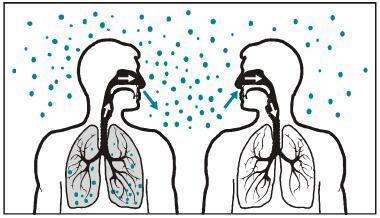 結(jié)核性胸膜炎