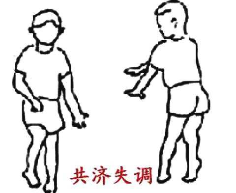 共濟(jì)失調(diào)