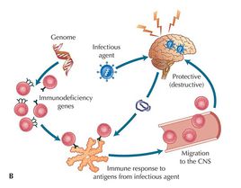 中樞神經(jīng)系統(tǒng)脫髓鞘疾病