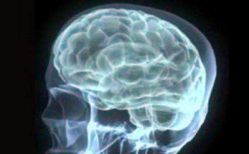 腦白質(zhì)軟化