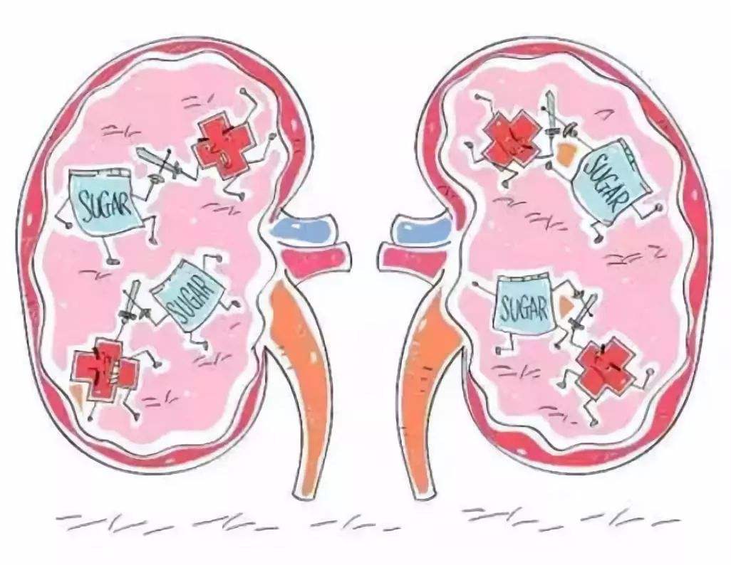 慢性腎小球腎炎