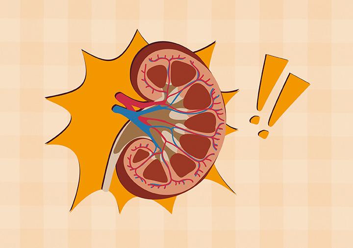 隱匿性腎小球腎炎