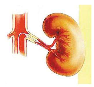 腎血管性高血壓