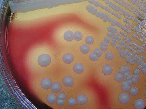 葡萄球菌性燙傷樣皮膚綜合征