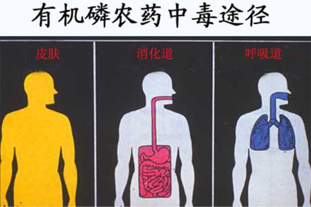 有機磷殺蟲藥中毒