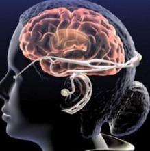 顱內(nèi)壓增高