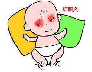 過敏性結(jié)膜炎