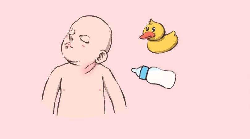 先天性肌性斜頸