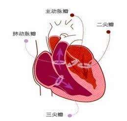 二尖瓣脫垂綜合癥