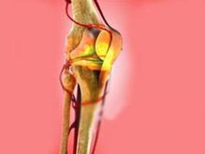 動(dòng)脈瘤性骨囊腫