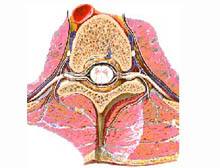 椎管內(nèi)囊腫