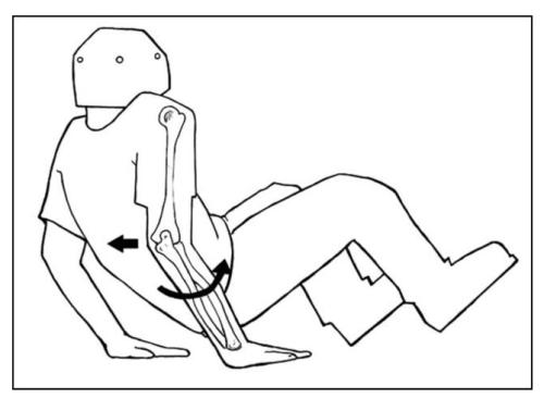 肘關(guān)節(jié)脫位