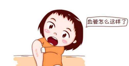 原發(fā)性下肢深靜脈瓣膜關(guān)閉不全