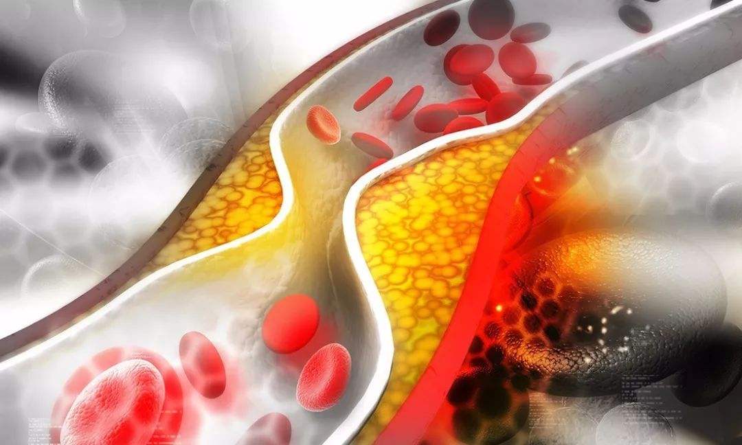 變應(yīng)性血管炎