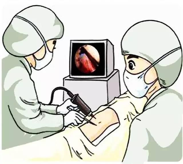 關(guān)節(jié)鏡