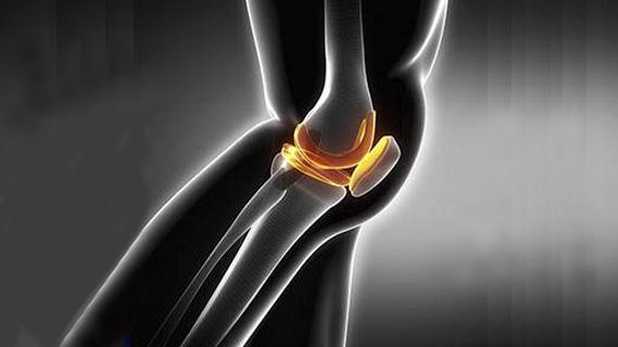 骨關(guān)節(jié)結(jié)核