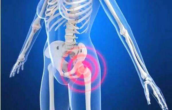 先天性髖關(guān)節(jié)脫位