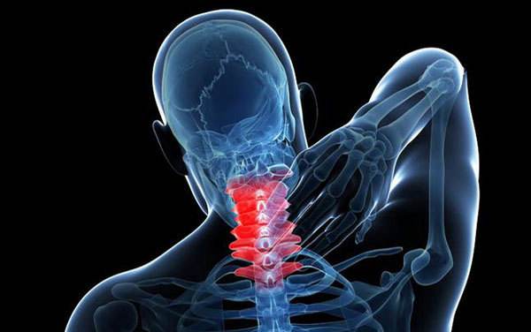 椎動脈型頸椎病