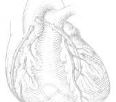 冠狀動(dòng)靜脈瘺