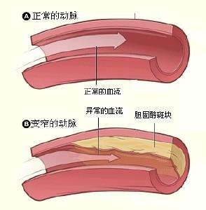 視膜毛細血管前小動脈