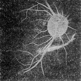 視網膜震蕩與挫傷