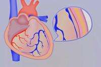 原發(fā)性心臟腫瘤