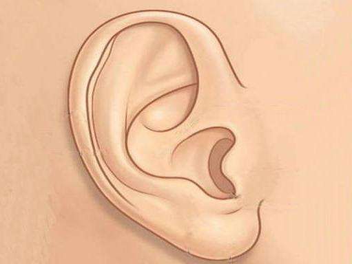 耳廓化膿性軟骨膜炎