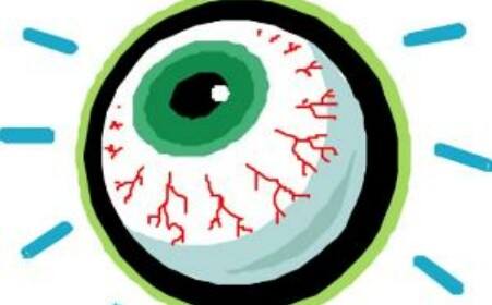 繼發(fā)性青光眼