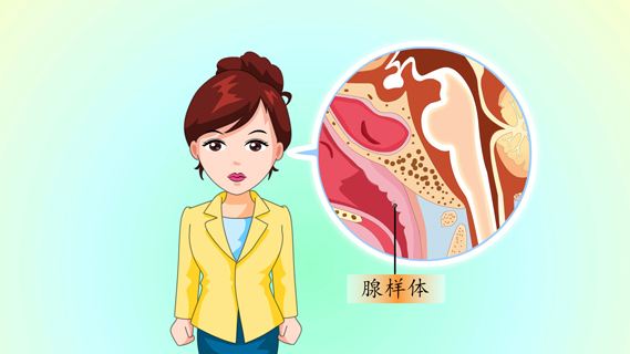 小兒腺樣體肥大