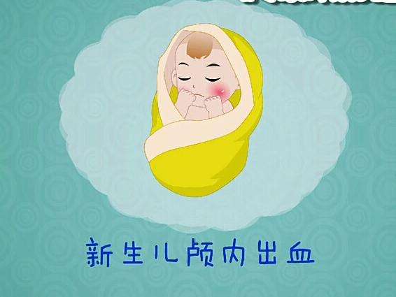 新生兒顱內(nèi)出血