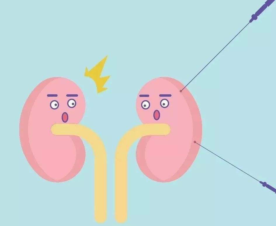 妊娠合并腎病綜合征