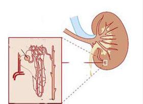 小兒腎小管性酸中毒