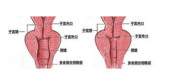 女性生殖器官創(chuàng)傷