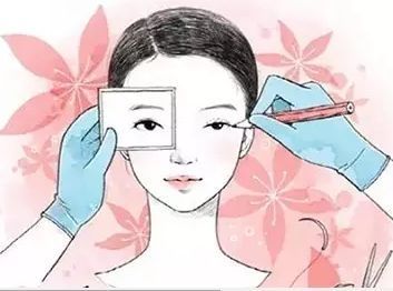 雙眼皮修復(fù)
