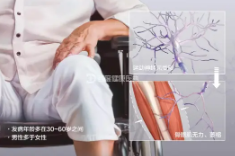 肌萎縮側(cè)索硬化