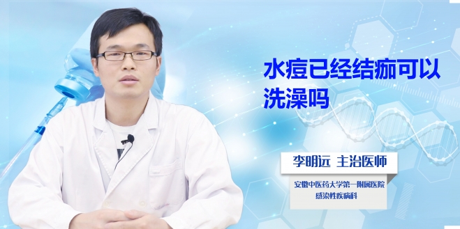 水痘已經(jīng)結(jié)痂可以洗澡嗎？