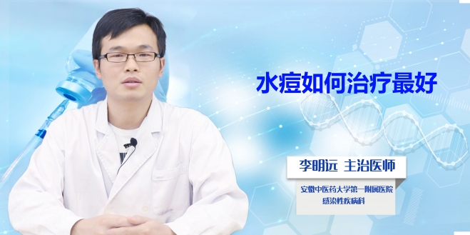 水痘如何治療最好?